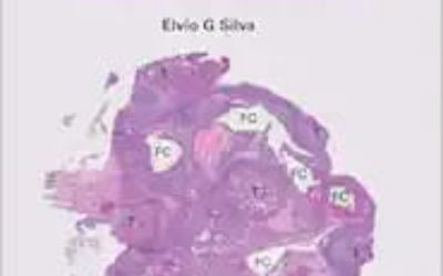 Fere Ex Nihilo — Ovarian Oncogenesis Recapitulates Phylogenesis: A Hormonal Approach to Ovarian Cancer Mirroring the Development of the Müllerian Tract