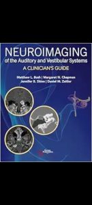 Neuroimaging of the Auditory and Vestibular Systems: A Clinician’s Guide First Edition