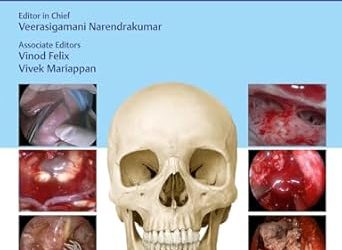 100 Complications of Otorhinolaryngology & Skull Base Surgery: Each Case Report from Different Surgeons Around the Globe