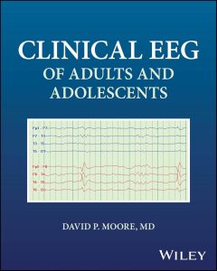 Clinical EEG of Adults and Adolescents First Edition