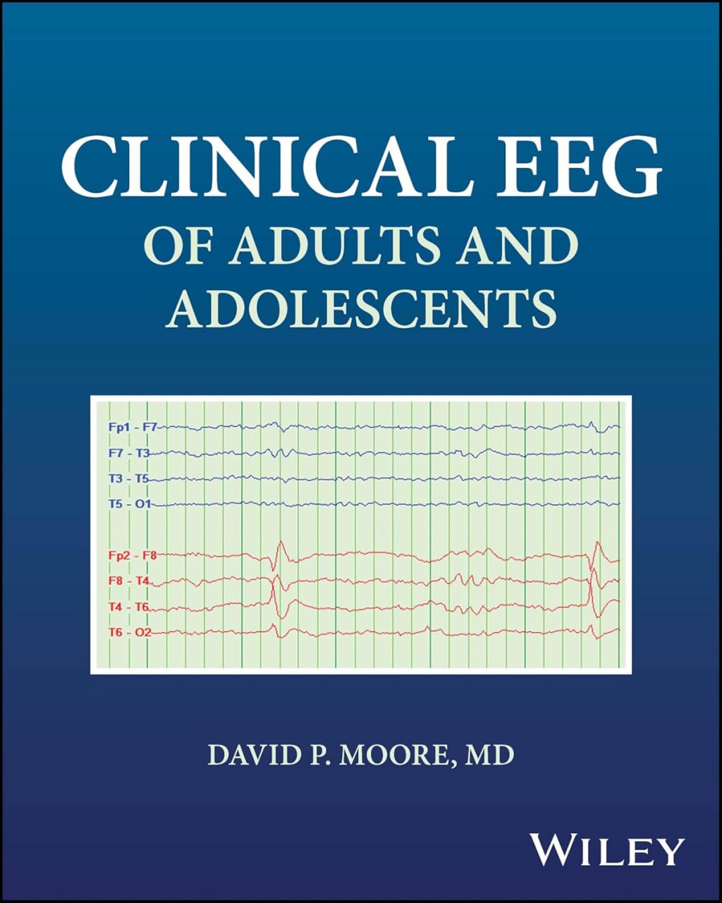 WhatsApp Image 2025-04-30 at 17.29.54 Clinical EEG of Adults and Adolescents First Edition
