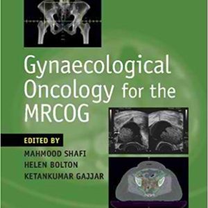 Gynaecological Oncology for the MRCOG First Edition
