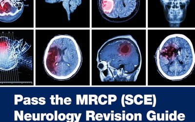 Pass the MRCP (SCE) Neurology Revision Guide First Edition