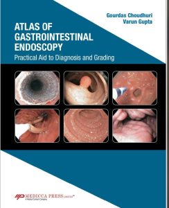 Atlas of Gastrointestinal Endoscopy Practical Aid to Diagnosis and Grading First Edition