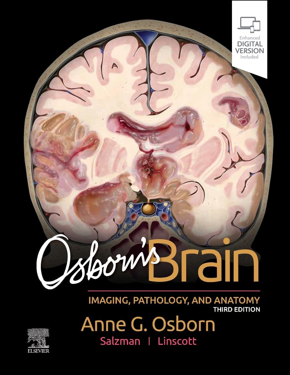 WhatsApp Image 2025-05-01 at 22.58.07 Osborn’s Brain Imaging Pathology And Anatomy Third Edition