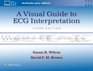 A Visual Guide to ECG Interpretation Third Edition