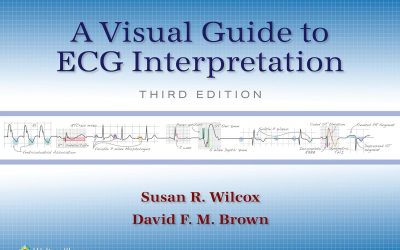 A Visual Guide to ECG Interpretation Third Edition