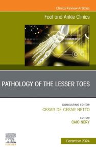 Pathology of the Lesser Toes, An issue of Foot and Ankle Clinics of North America (Volume 29-4) (The Clinics: Orthopedics, Volume 29-4)
