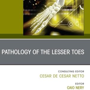 Pathology of the Lesser Toes, An issue of Foot and Ankle Clinics of North America (Volume 29-4) (The Clinics: Orthopedics, Volume 29-4)