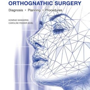 Optimizing Orthognathic Surgery: Diagnosis, Planning, Procedures First Edition