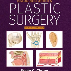 Grabb and Smith’s Plastic Surgery Ninth Edition