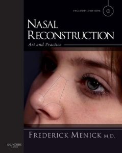 Nasal Reconstruction: Art and Practice 1st Edition
