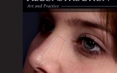 Nasal Reconstruction: Art and Practice 1st Edition
