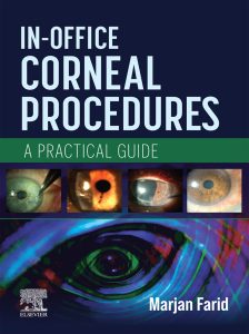 In-Office Corneal Procedures: A Practical Guide First Edition