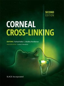 Corneal Cross-Linking Second Edition