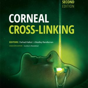 Corneal Cross-Linking Second Edition