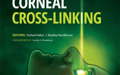 Corneal Cross-Linking Second Edition