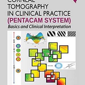 Corneal Tomography in Clinical Practice Fourth Edition