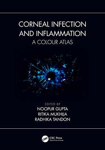 WhatsApp Image 2025-05-07 at 09.37.48 Corneal Infection and Inflammation: A Colour Atlas First Edition