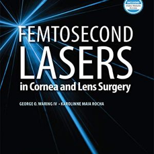 Femtosecond Lasers in Cornea and Lens Surgery First Edition