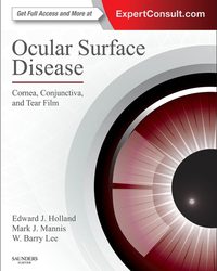 Ocular Surface Disease: Cornea, Conjunctiva and Tear Film First Edition