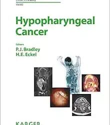 Hypopharyngeal Cancer First Edition