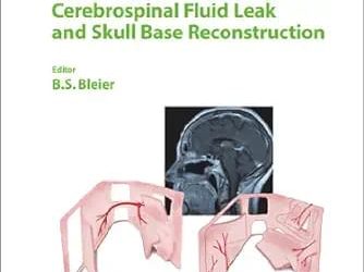 Comprehensive Techniques in Csf Leak Repair and Skull Base Reconstruction First Edition