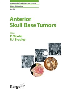 Anterior Skull Base Tumors First Edition