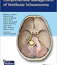 Comprehensive Management of Vestibular Schwannoma First Edition