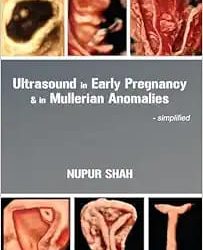 Ultrasound in Early Pregnancy & in Mullerian Anomalies – Simplified