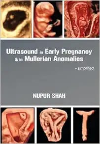 Ultrasound in Early Pregnancy & in Mullerian Anomalies – Simplified