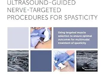 Atlas of Ultrasound-Guided Nerve-Targeted Procedures for Spasticity
