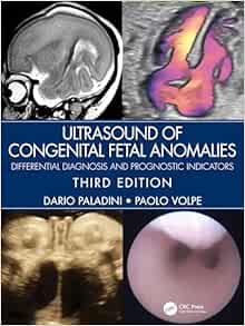 Ultrasound of Congenital Fetal Anomalies: Differential Diagnosis and Prognostic Indicators Third Edition