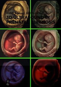 3D Ultrasound in Prenatal Diagnosis: A Practical Approach Second edition