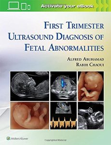 First Trimester Ultrasound Diagnosis of Fetal Abnormalities First Edition