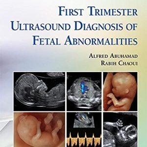 First Trimester Ultrasound Diagnosis of Fetal Abnormalities First Edition
