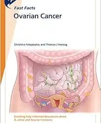 Fast Facts: Ovarian Cancer