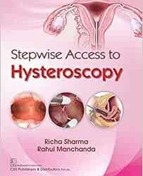 STEPWISE ACCESS TO HYSTEROSCOPY