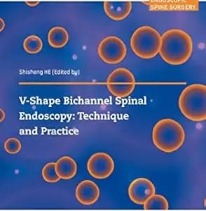 V-shape Bichannel Spinal Endoscopy: Technique and Practice