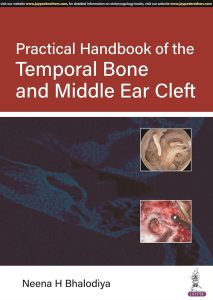 Practical Handbook of the Temporal Bone and Middle Ear Cleft First Edition
