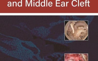 Practical Handbook of the Temporal Bone and Middle Ear Cleft First Edition