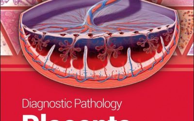 Diagnostic Pathology: Placenta Third Edition