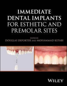 Immediate Dental Implants for Esthetic and Premolar Sites First Edition