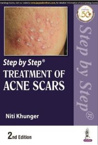 Step by Step Treatment of Acne Scars Second Edition