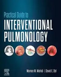 Practical Guide to Interventional Pulmonology First Edition