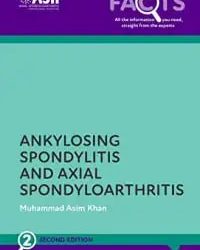 Ankylosing Spondylitis and Axial Spondyloarthritis Second Edition