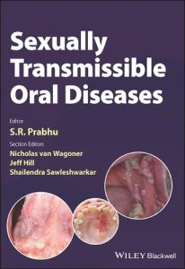 Sexually Transmissible Oral Diseases First Edition