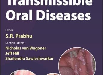 Sexually Transmissible Oral Diseases  First Edition