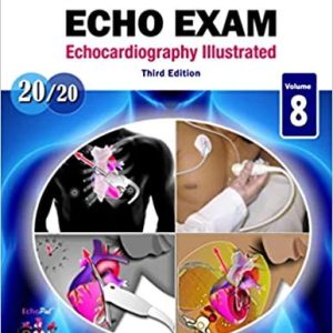 How to Do An Echo Exam: Third Edition
