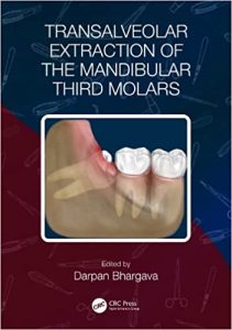 Transalveolar Extraction of the Mandibular Third Molars First Edition